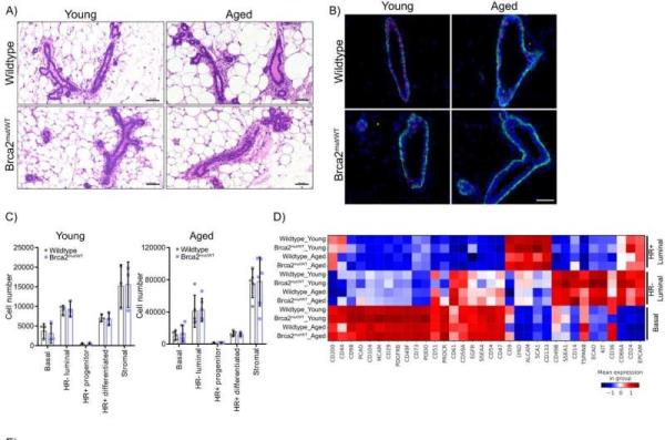 Study provides insights into early breast cancer development in individuals with BRCA2 mutations